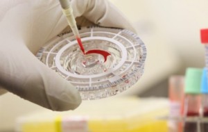 MALARIA D’IMPORTAZIONE. NULLA DA TEMERE