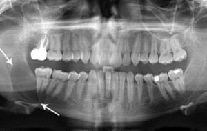 A UDINE CONVEGNO INTERNAZIONALE  SULLA CHIRURGIA MAXILLO-FACCIALE