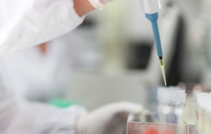 MIELOMA MULTIPLO: ANCORA INGUARIBILE MA…