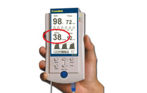 CAPNOGRAFI IN DONO DA GRUPPO FERRI