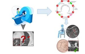 POLMONI E TAC: PASSI IN AVANTI CON LA LUCE DI ELETTRA