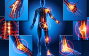 FIBROMIALGIA: DUE ANNI DI AISF ODV IN FRIULI VENEZIA GIULIA